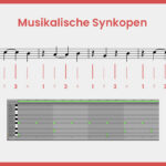 Musikalische Synkope