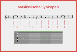 Musikalische Synkope