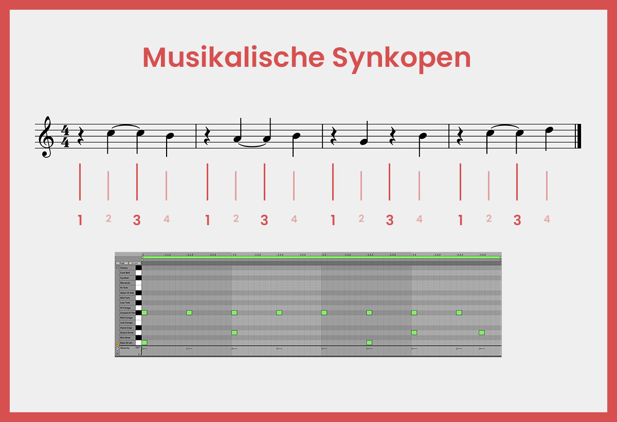 Syncope musicale